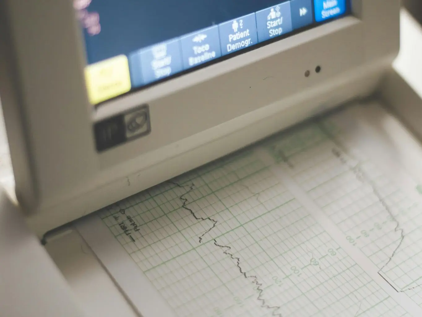 EKG Papier